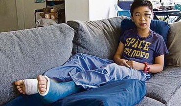 洋名为拉塞尔(Russell)的华裔男童，脚部骨折。（加拿大《星岛日报》援引CBC电视图片）