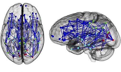 男性的大脑神经图。