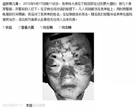 网曝男子拒盘查 遭民警喷液烧伤脸（图）